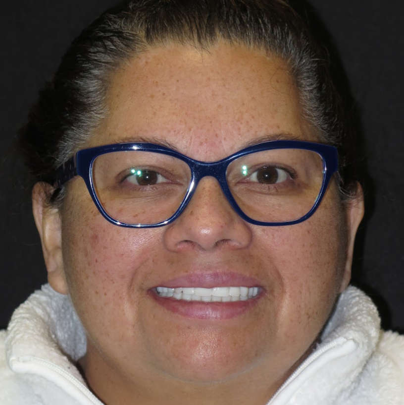 Woman with glasses after cosmetic dentistry photo