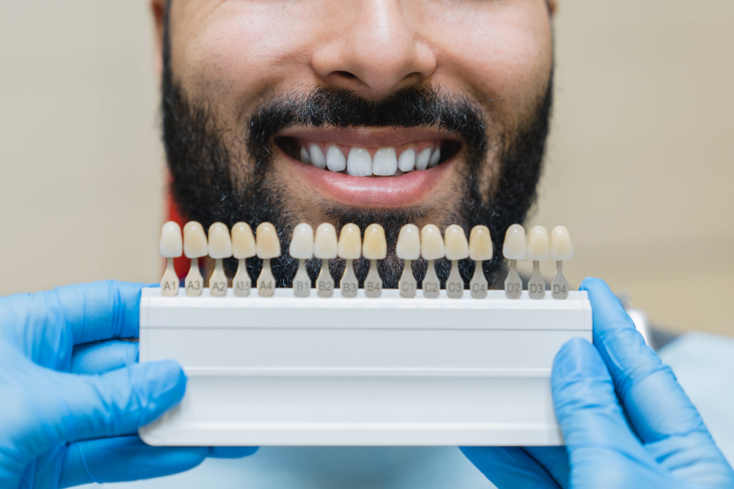 Grouping of veneers being held up to man's mouth to match color.