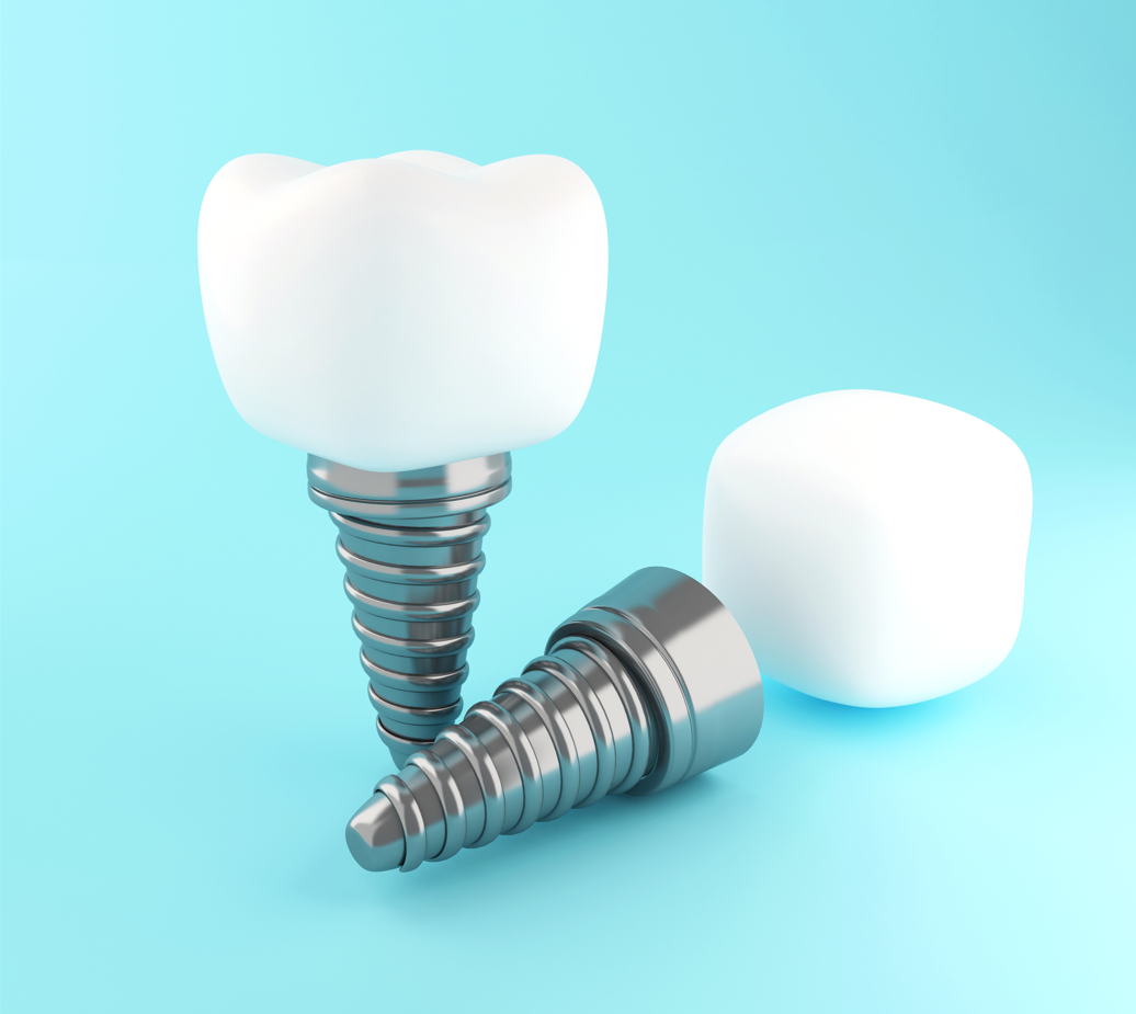 Singular dental implants on light blue background.